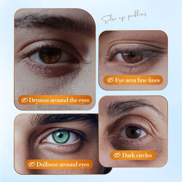 80pcs-Sadoer-Coconut-Crystal-Collagen-Eye-Mask-Anti-Dark-Circles-Anti-Wrinkles-Moisturizing-Eye-Patches-Skin.jpg